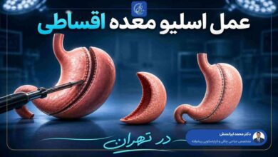 - خطرات واقعی عمل اسلیو معده چیست؟دکتر محمد ایرانمنش پاسخ می دهد